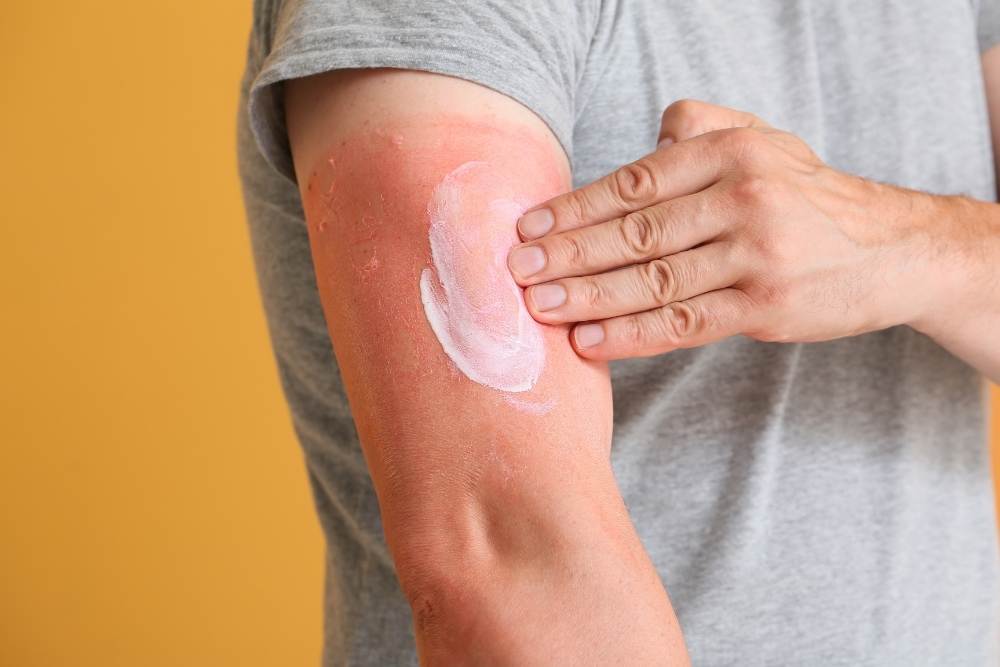 man uses body cream on his arm