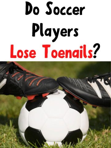 Do Soccer Players Lose Toenails?