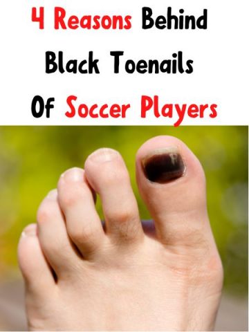 Why Do Soccer Players Have Black Toenails?